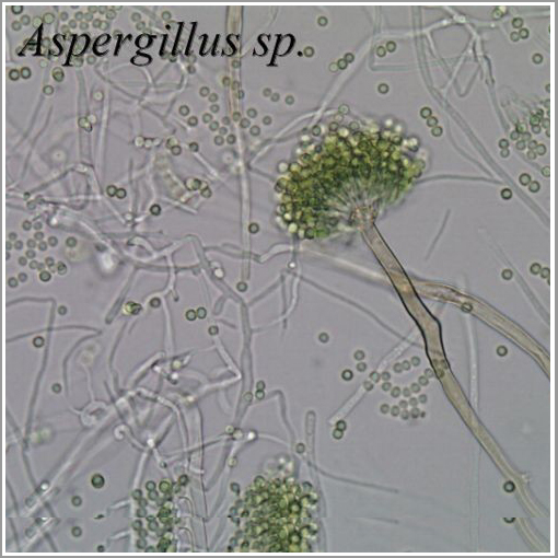 mold under microscope